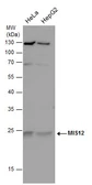 Anti-MIS12 antibody used in Western Blot (WB). GTX130138