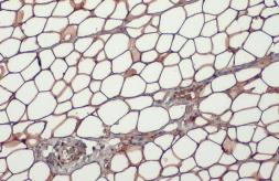 Anti-Perilipin 1 antibody used in IHC (Paraffin sections) (IHC-P). GTX130139