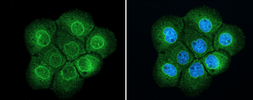 Anti-TPR antibody used in Immunocytochemistry/ Immunofluorescence (ICC/IF). GTX130142