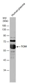 Anti-TCN1 antibody used in Western Blot (WB). GTX130151