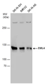 Anti-EML4 antibody used in Western Blot (WB). GTX130169