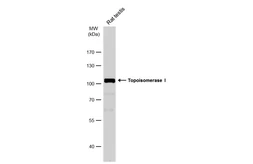 Anti-Topoisomerase I antibody used in Western Blot (WB). GTX130177