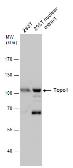 Anti-Topoisomerase I antibody used in Western Blot (WB). GTX130178