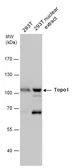 Anti-Topoisomerase I antibody used in Western Blot (WB). GTX130178