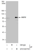 Anti-SUZ12 antibody used in Immunoprecipitation (IP). GTX130179