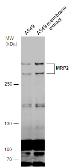 Anti-MRP2 antibody used in Western Blot (WB). GTX130181