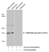 Anti-NMDAR2B (phospho Tyr1472) antibody used in Western Blot (WB). GTX130183