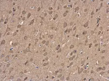 Anti-NMDAR2B antibody used in IHC (Paraffin sections) (IHC-P). GTX130184