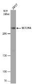 Anti-SETD1A antibody used in Western Blot (WB). GTX130194
