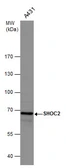 Anti-SHOC2 antibody used in Western Blot (WB). GTX130206