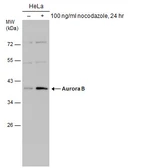 Anti-Aurora B antibody used in Western Blot (WB). GTX130211