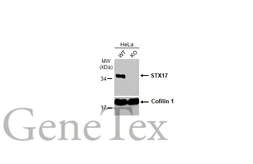 Anti-STX17 antibody used in Western Blot (WB). GTX130212