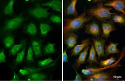 Anti-RPL32 antibody used in Immunocytochemistry/ Immunofluorescence (ICC/IF). GTX130214