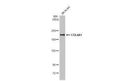 Anti-COL4A1 antibody used in Western Blot (WB). GTX130215