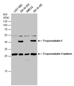 Anti-Tropomodulin 1 antibody used in Western Blot (WB). GTX130237