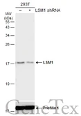 Anti-LSM1 antibody used in Western Blot (WB). GTX130240