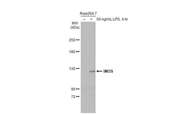 Anti-iNOS antibody used in Western Blot (WB). GTX130246