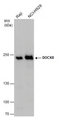 Anti-DOCK8 antibody used in Western Blot (WB). GTX130251