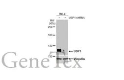 Anti-USP1 antibody used in Western Blot (WB). GTX130252
