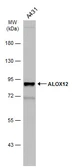 Anti-ALOX12 antibody used in Western Blot (WB). GTX130257