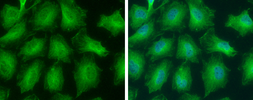 Anti-GNPDA2 antibody used in Immunocytochemistry/ Immunofluorescence (ICC/IF). GTX130289