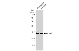 Anti-ASMT antibody used in Western Blot (WB). GTX130292