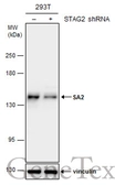 Anti-SA2 antibody used in Western Blot (WB). GTX130298