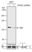 Anti-SA2 antibody used in Western Blot (WB). GTX130304