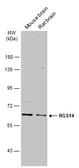 Anti-RGS14 antibody used in Western Blot (WB). GTX130309