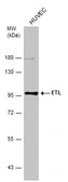 Anti-ETL antibody used in Western Blot (WB). GTX130314