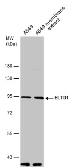 Anti-ETL antibody used in Western Blot (WB). GTX130314