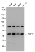 Anti-TCPTP antibody used in Western Blot (WB). GTX130319