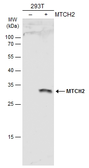 Anti-MTCH2 antibody used in Western Blot (WB). GTX130324