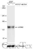 Anti-ATXN2 antibody used in Western Blot (WB). GTX130329