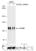 Anti-ATXN2 antibody used in Western Blot (WB). GTX130329
