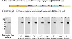 Multiple Tags Positive Control (GST-DDDDK-V5-HSV-HA-T7-Myc-S). GTX130343-pro