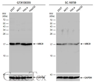 Anti-UBE2I antibody used in Western Blot (WB). GTX130355