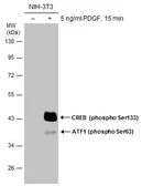Anti-CREB (phospho Ser133) antibody used in Western Blot (WB). GTX130379