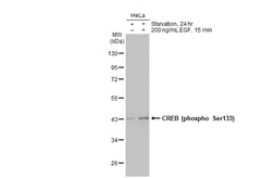 Anti-CREB (phospho Ser133) antibody used in Western Blot (WB). GTX130379