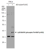 Anti-p38 MAPK (phospho Thr180/Tyr182) antibody used in Western Blot (WB). GTX130383
