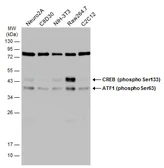 Anti-ATF1 (phospho Ser63) antibody used in Western Blot (WB). GTX130420
