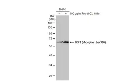 Anti-IRF3 (phospho Ser386) antibody used in Western Blot (WB). GTX130422