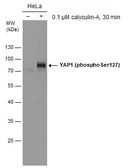 Anti-YAP1 (phospho Ser127) antibody used in Western Blot (WB). GTX130424