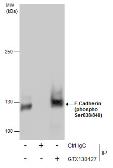 Anti-E-Cadherin (phospho Ser838/840) antibody used in Immunoprecipitation (IP). GTX130427