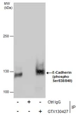 Anti-E-Cadherin (phospho Ser838/840) antibody used in Immunoprecipitation (IP). GTX130427