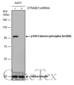 Anti-p120 Catenin (phospho Ser268) antibody used in Western Blot (WB). GTX130428