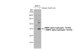 Anti-AMPK alpha 1 (phospho Thr183) + AMPK alpha 2 (phospho Thr172) antibody used in Western Blot (WB). GTX130429