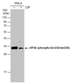 Anti-RPS6 (phospho Ser235/236) antibody used in Western Blot (WB). GTX130430