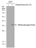 Anti-RPA32 (phospho Thr21) antibody used in Western Blot (WB). GTX130432