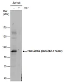 Anti-PKC alpha (phospho Thr497) antibody used in Western Blot (WB). GTX130433